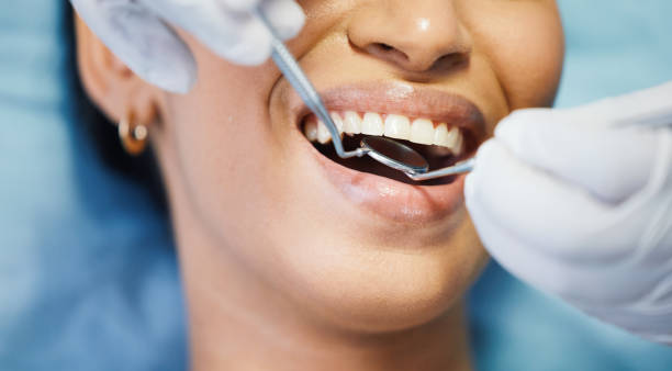 Best Emergency Tooth Extraction in Mustang, OK